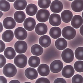 blood_cell_01.jpg