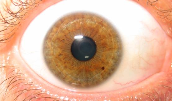 iridology-eye-hazel.jpg